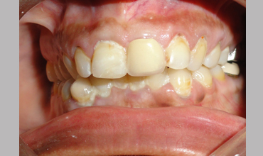 Oral surgery in Anand                        